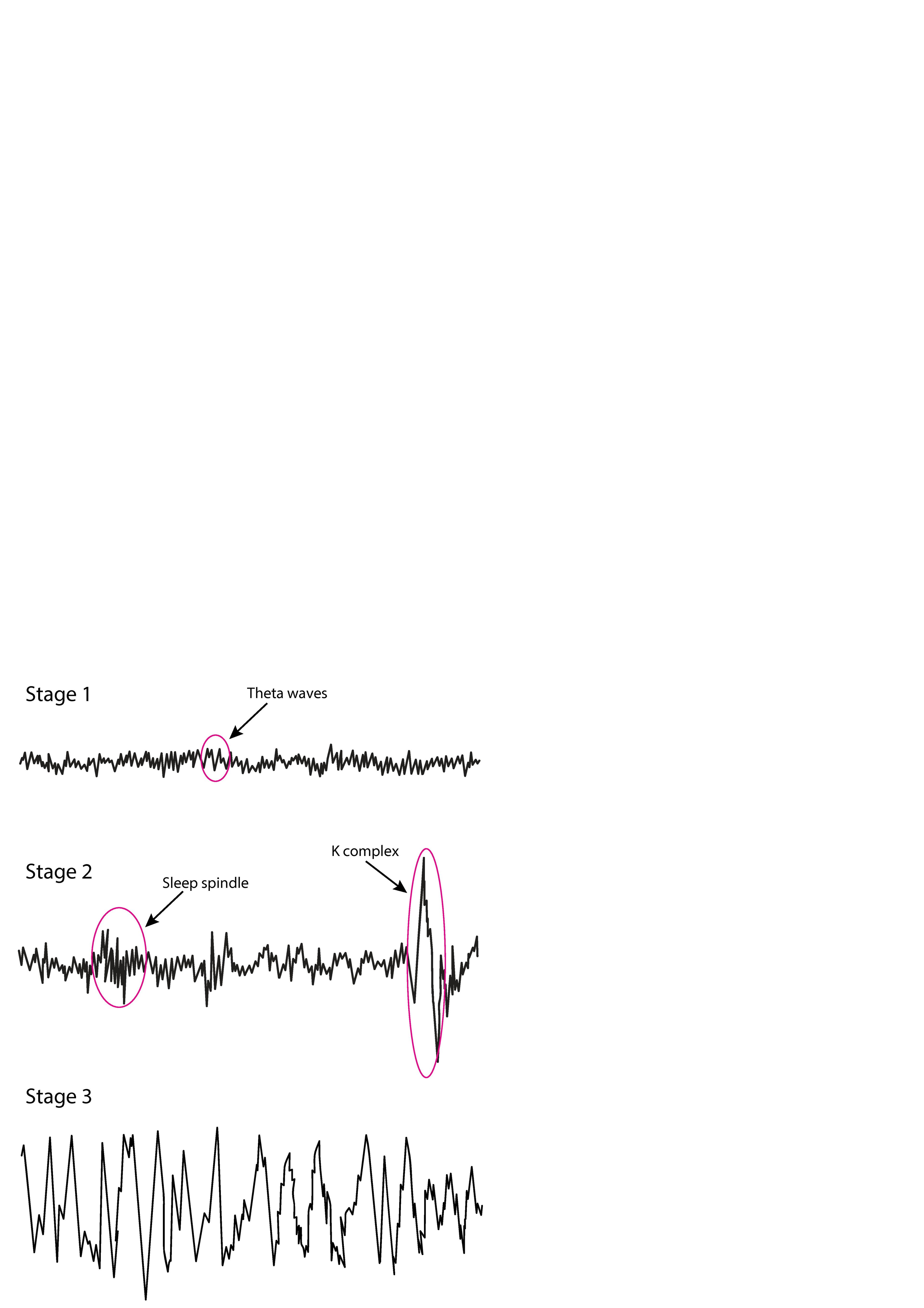 EEG durante el sueño sin movimientos oculares rápidos (NREM)