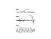 EEG lors des mouvements oculaires non rapides (Nonrapid eye movement, NREM)