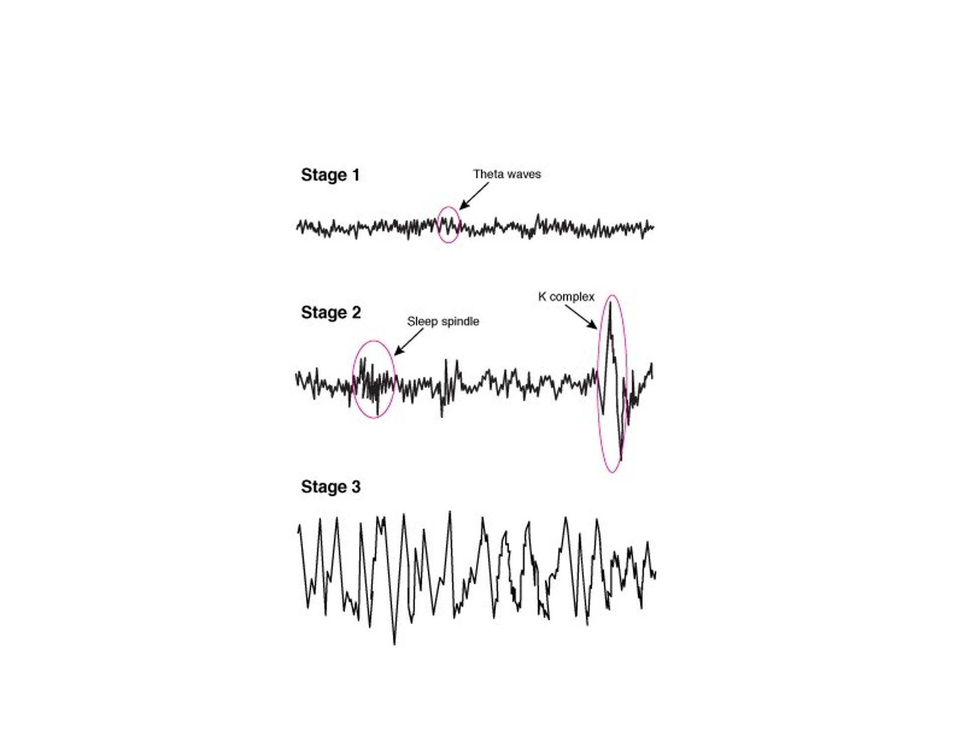 EEG lors des mouvements oculaires non rapides (Nonrapid eye movement, NREM)