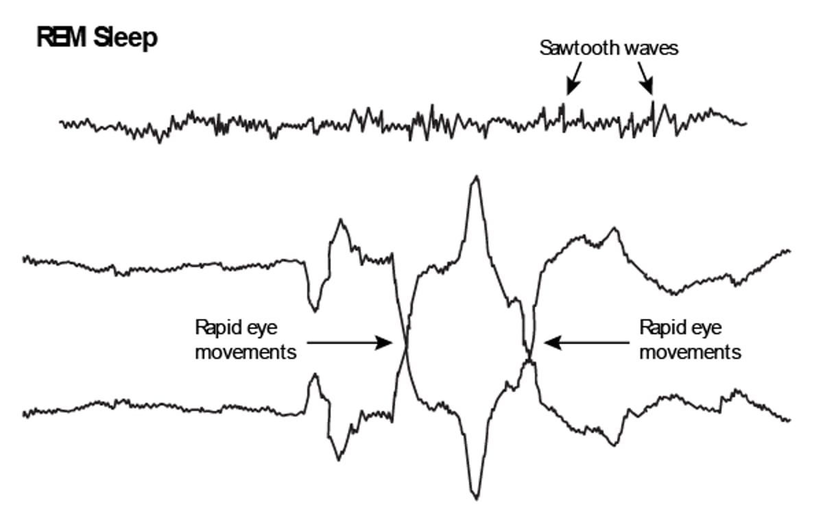 EEG de movimientos oculares rápidos (REM)