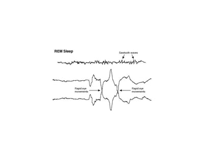 快速眼动(REM) EEG
