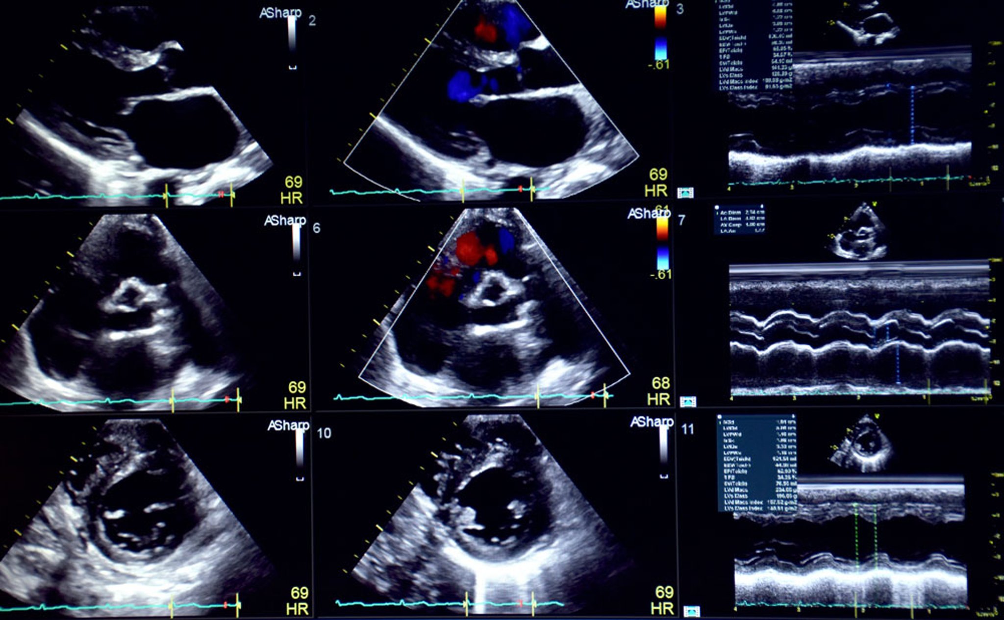 Echocardiogram (9-Panel Plot)
