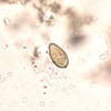 Opisthorchis Egg