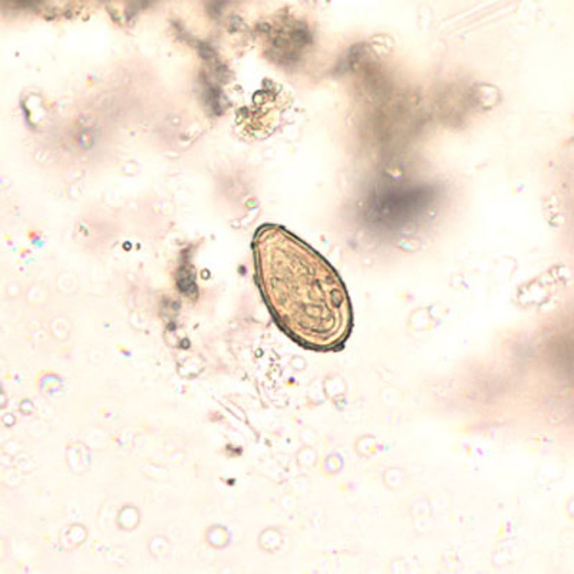 <i >Opisthorchis</i> Egg