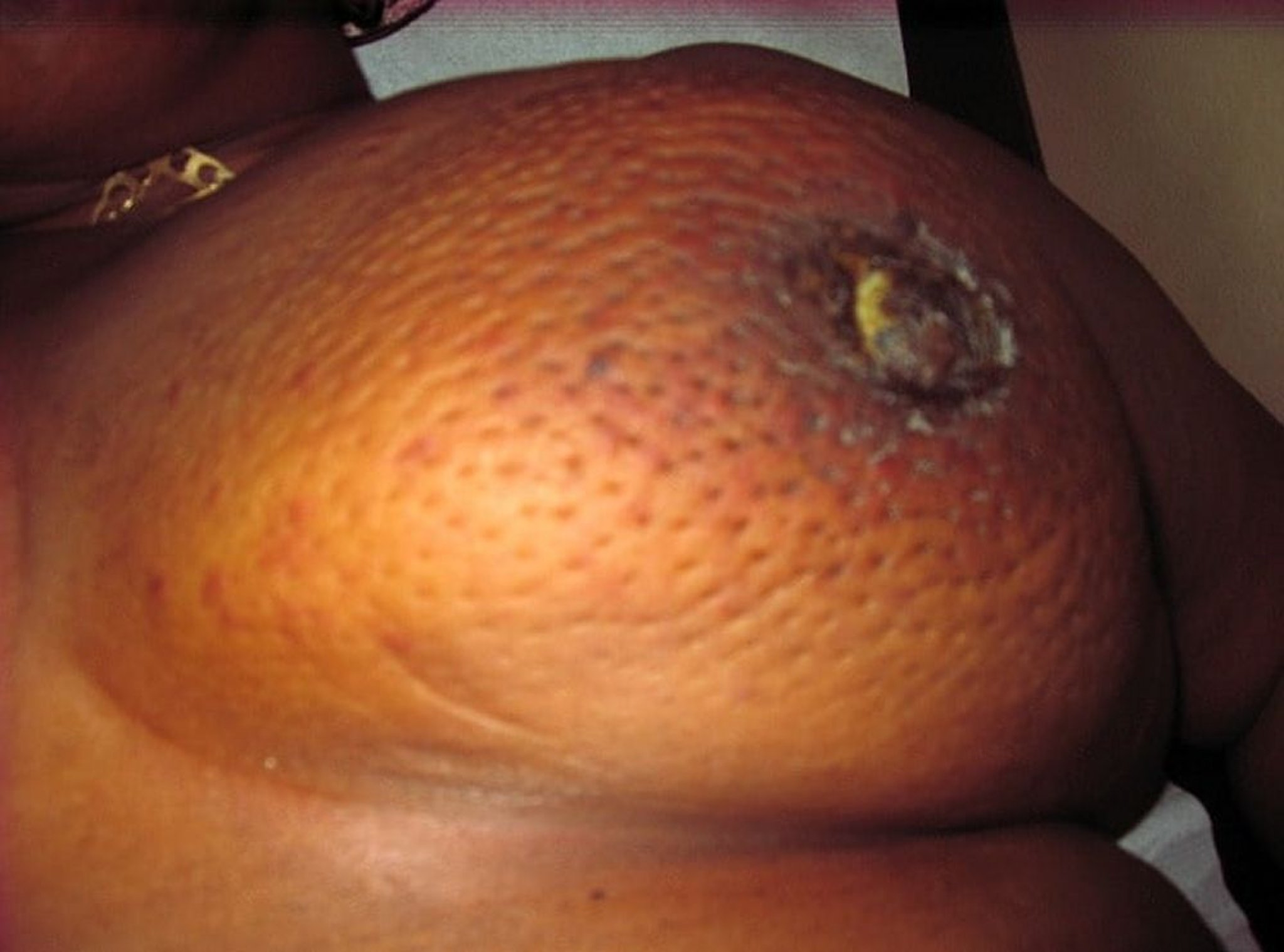 Aspecto em casca de laranja