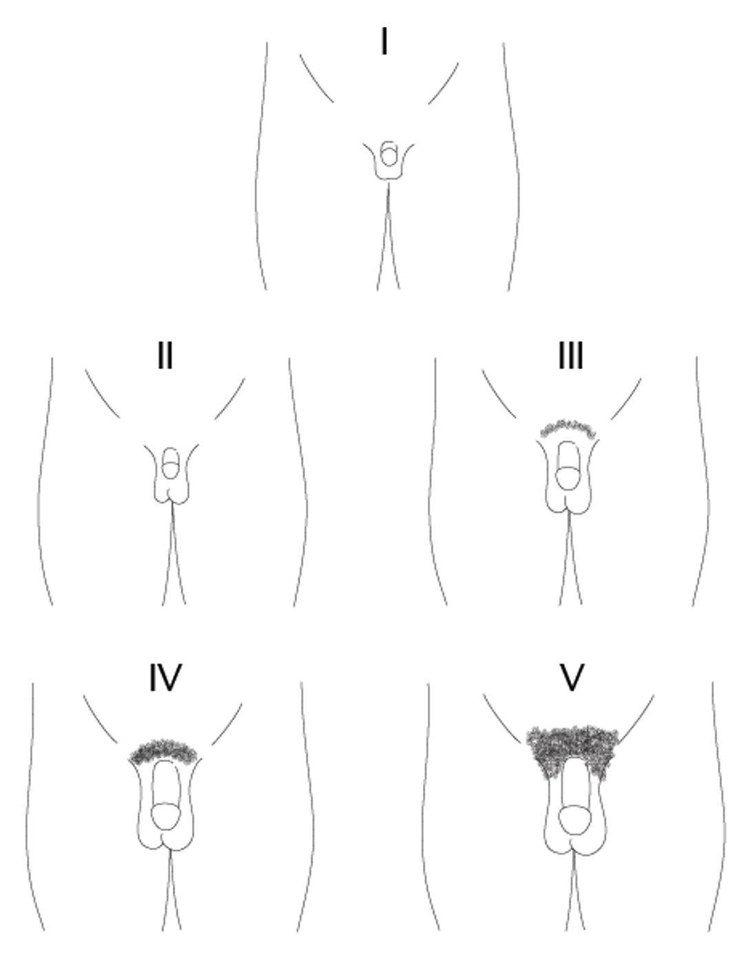 Représentation schématique des stades I à V du développement des poils pubiens et de la maturation du pénis chez les garçons