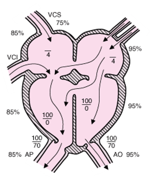 Defeito no septo atrioventricular (forma completa)