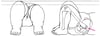 Признак галеацци