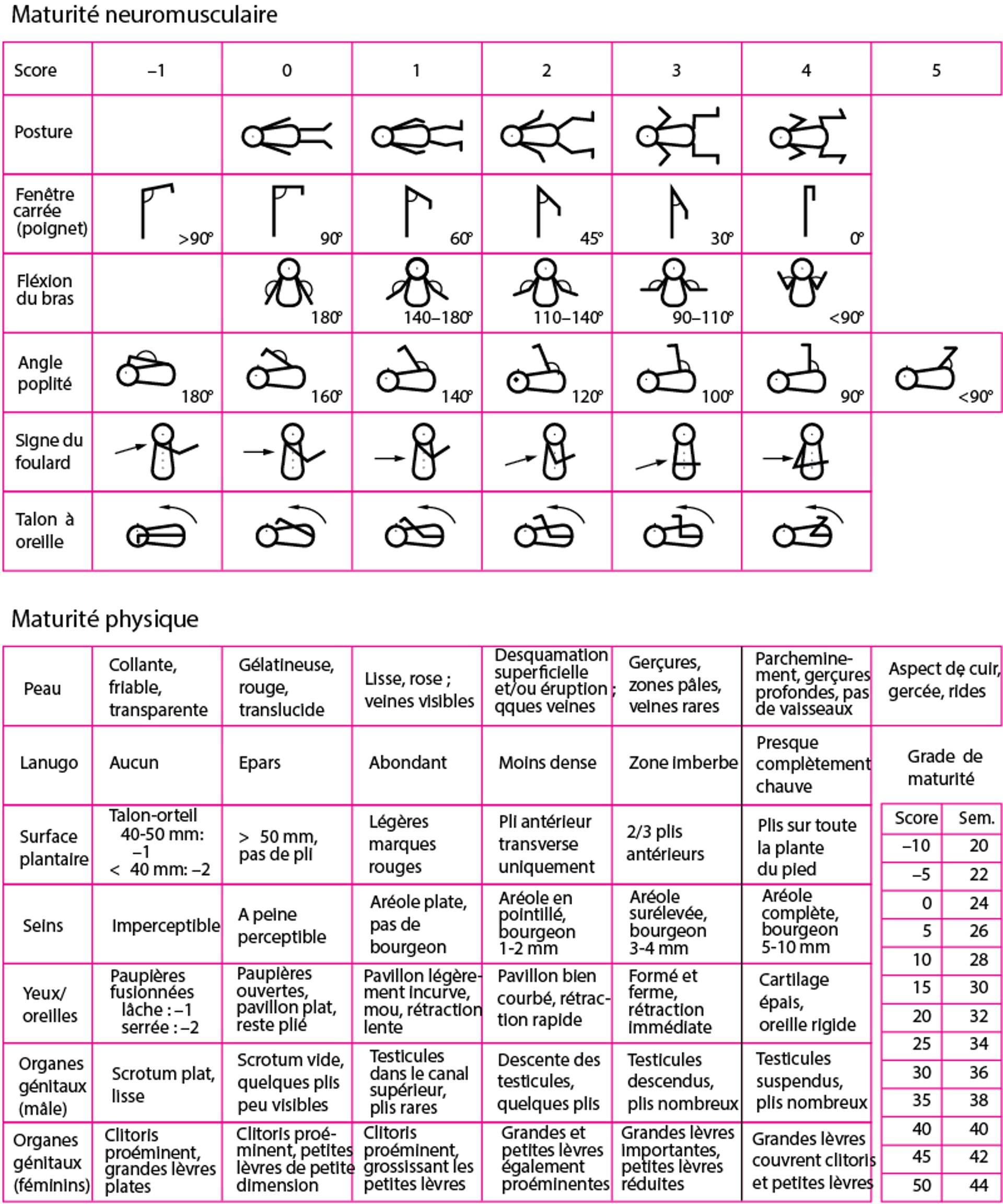 Évaluation de l'âge gestationnel, nouveau score de Ballard