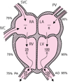正常循環における典型的な右心圧と左心圧（mmHg）