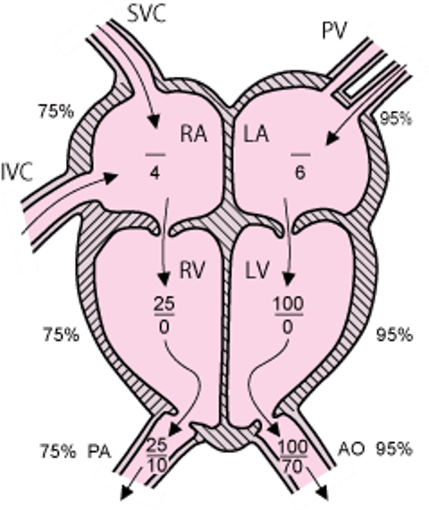 正常循環における典型的な右心圧と左心圧（mmHg）
