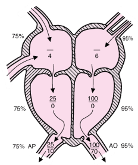 Circulação normal com representação das pressões cardíacas direita e esquerda (em mmHg)