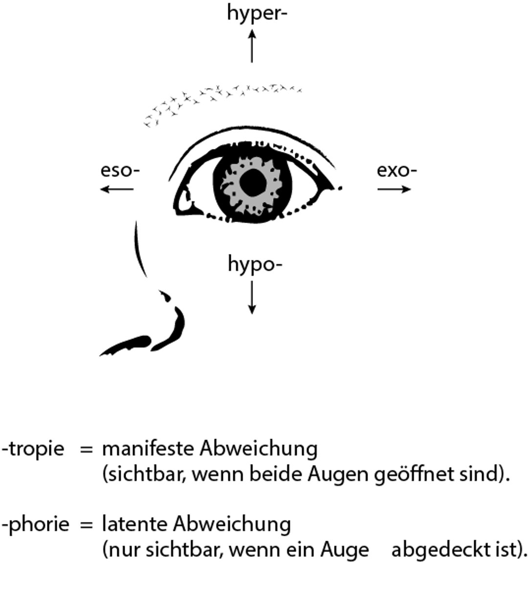 Okulare Abweichungen beim Strabismus