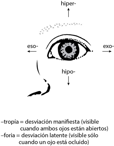 Estrabismo - Estrabismo - Manual Merck versión para profesionales