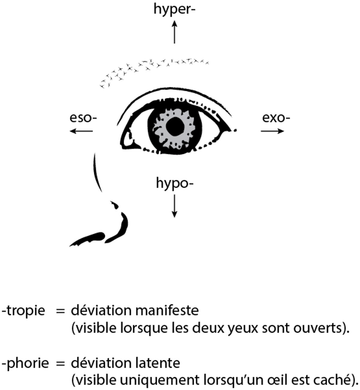 Déviations oculaires dans le strabisme