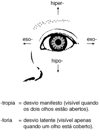 Desvios oculares no estrabismo