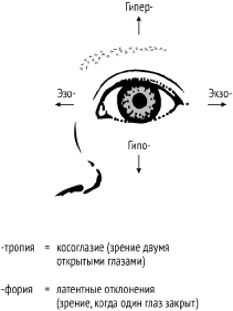Глазные отклонения при косоглазии