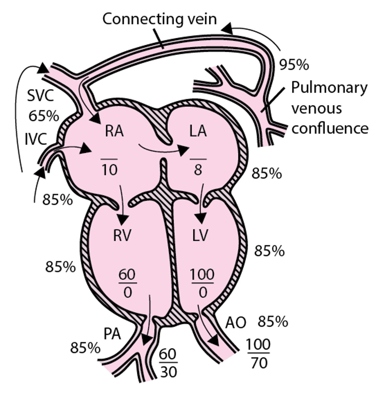 Total anomalous pulmonary venous return