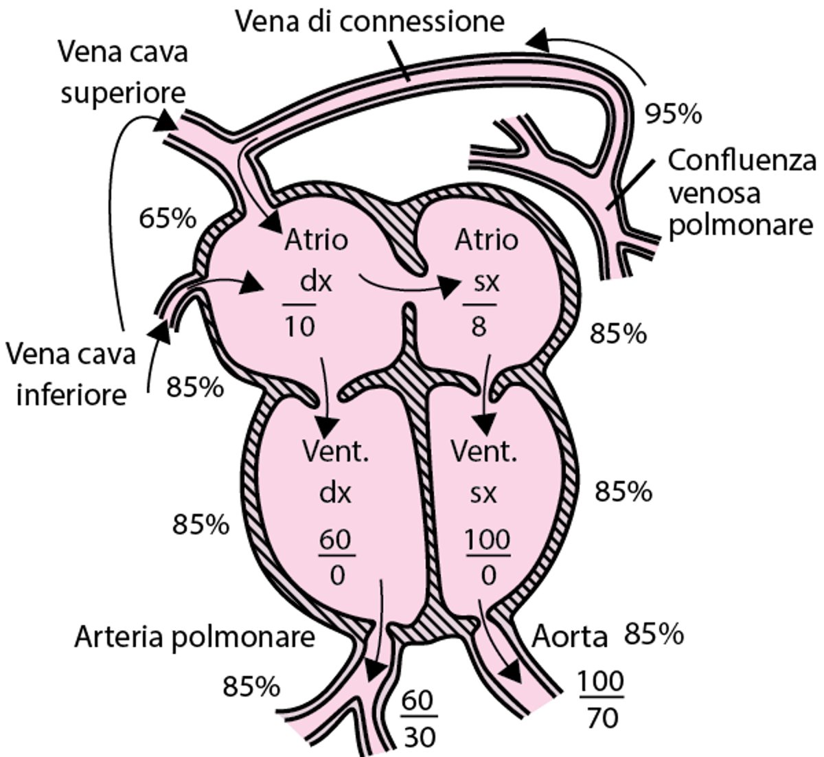 Ritorno venoso anomalo polmonare totale
