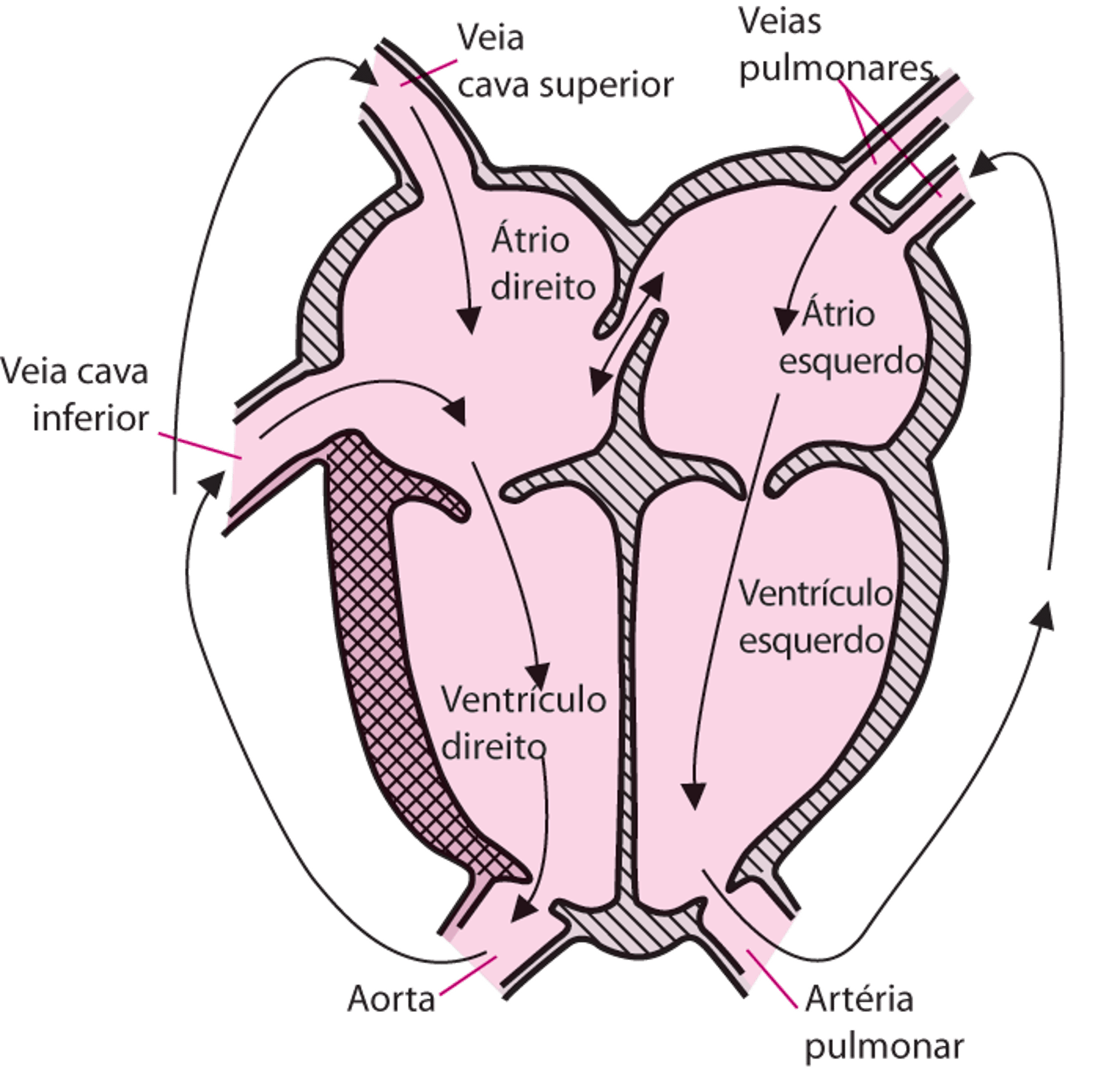 Retorno pulmonar venoso anômalo total