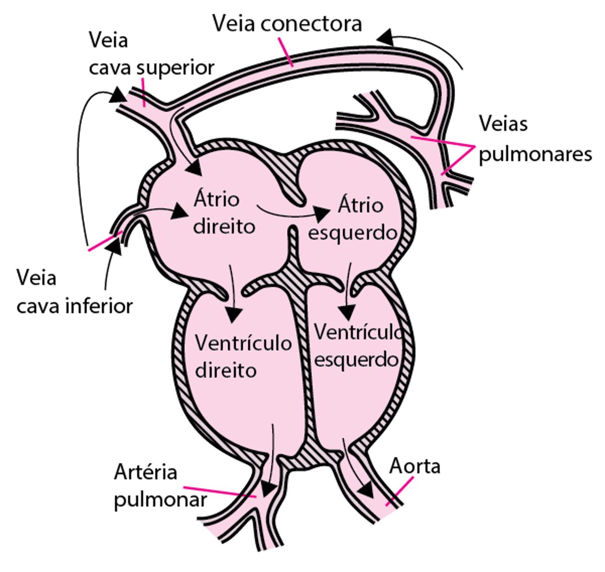 Retorno pulmonar venoso anômalo total