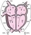 Dextro-trasposizione delle grandi arterie