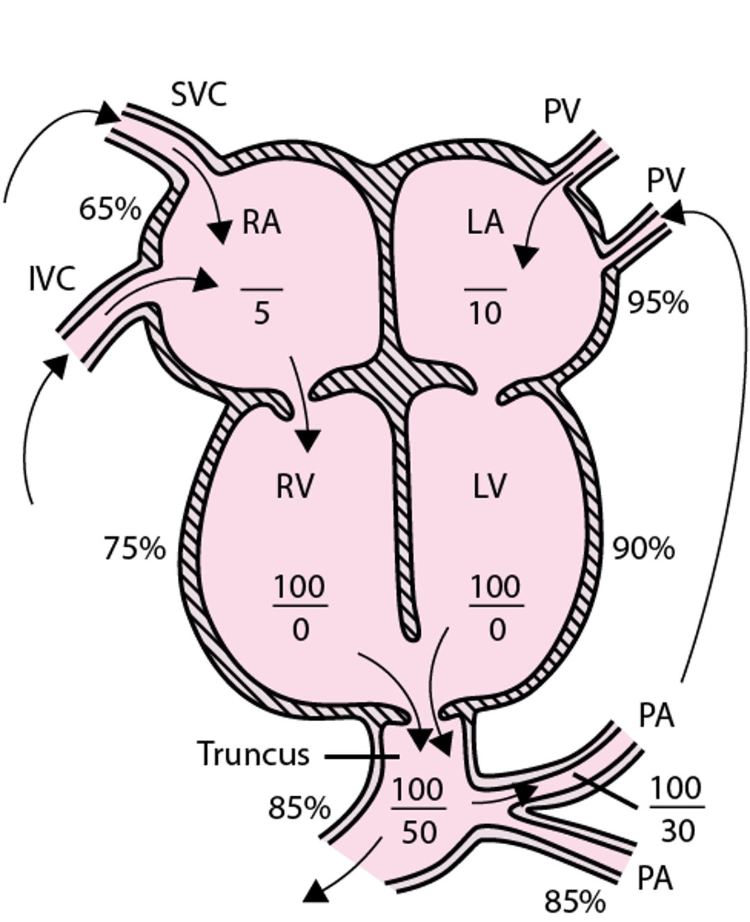 ImageTruncus arteriosusMSD Manual ProfiAusgabe