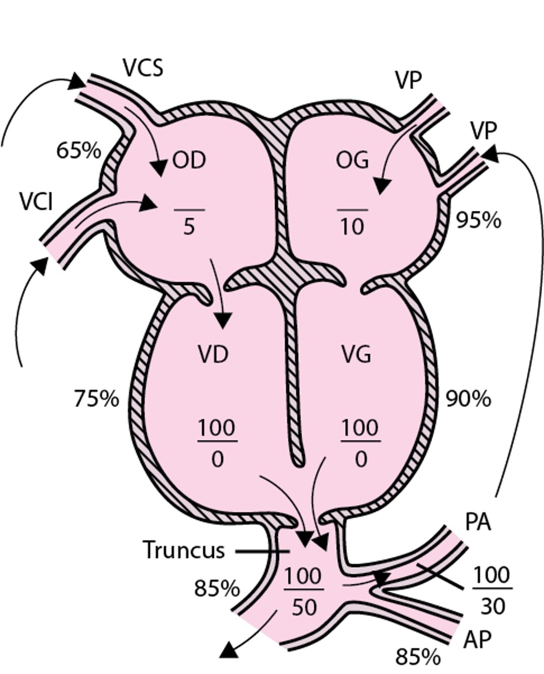 Truncus arteriosus (tronc artériel commun)