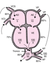 Tronco arterioso