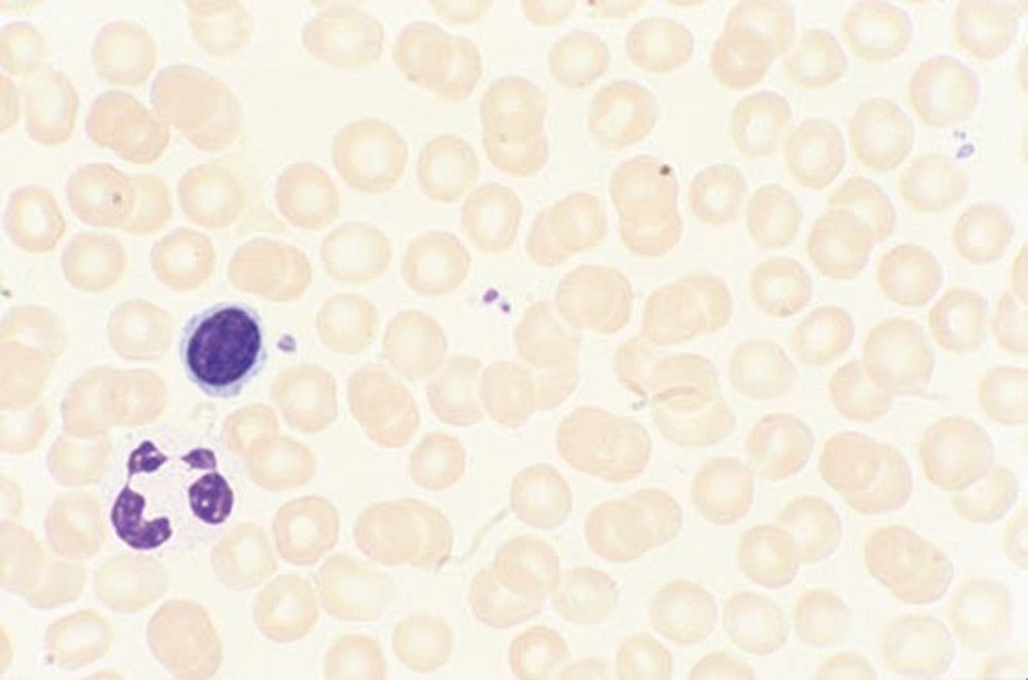 Peripheral Blood Smear, Normal