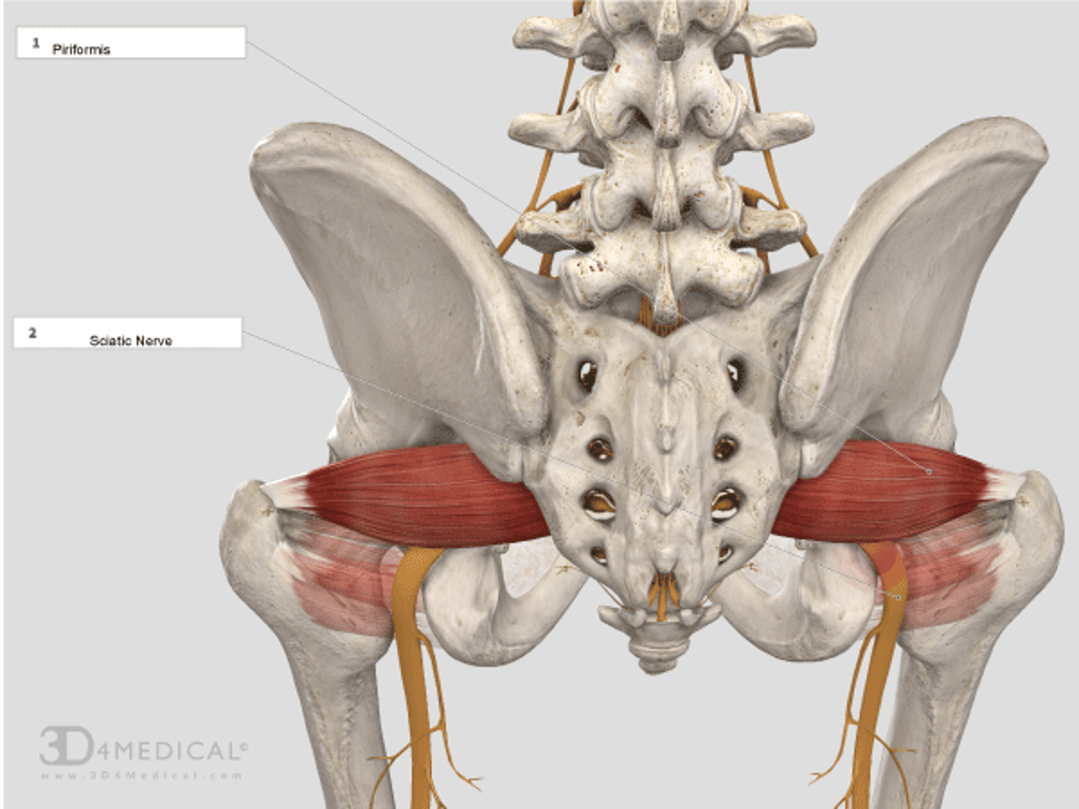 Piriformis Syndrome