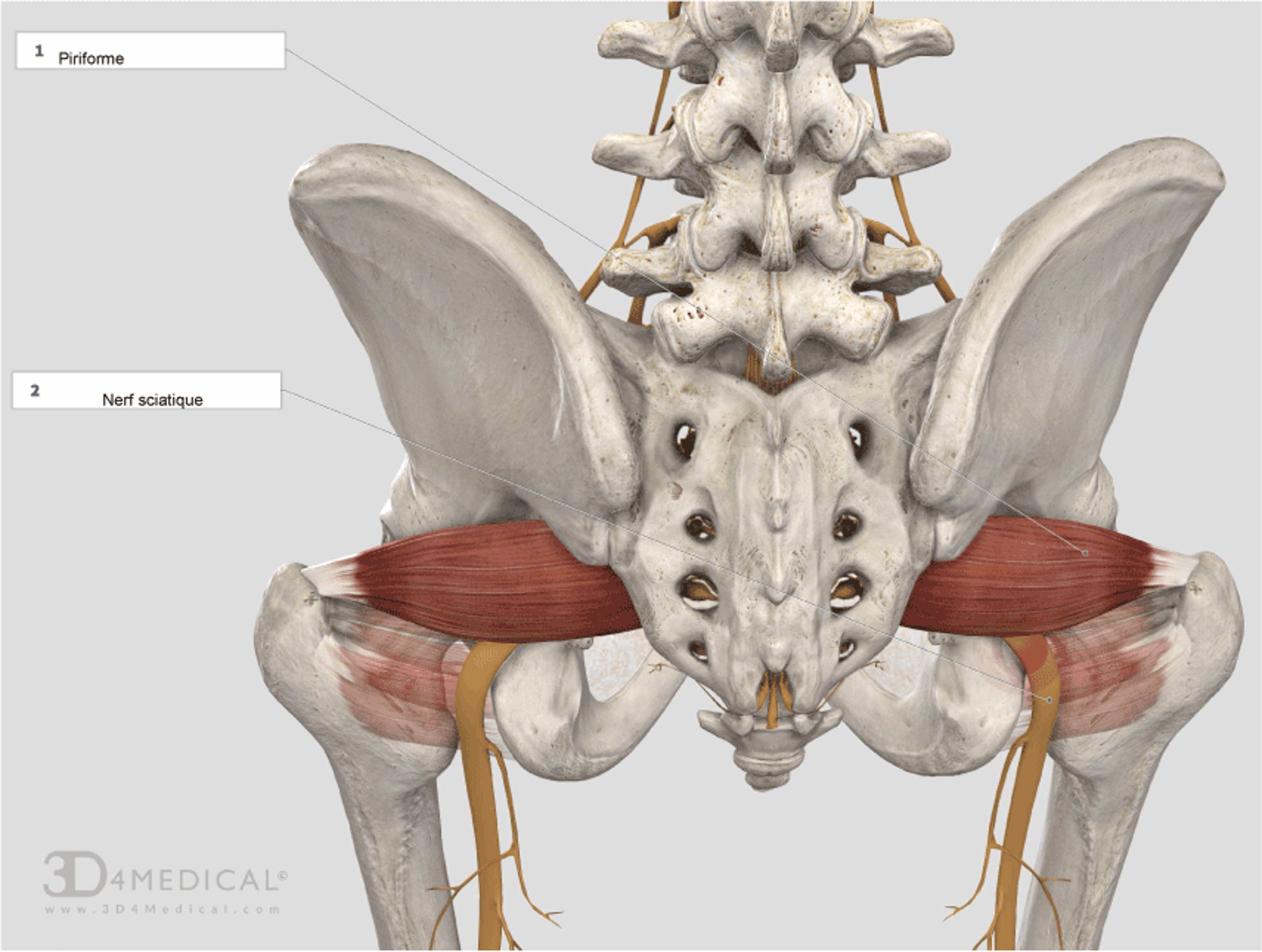 Syndrome du piriforme