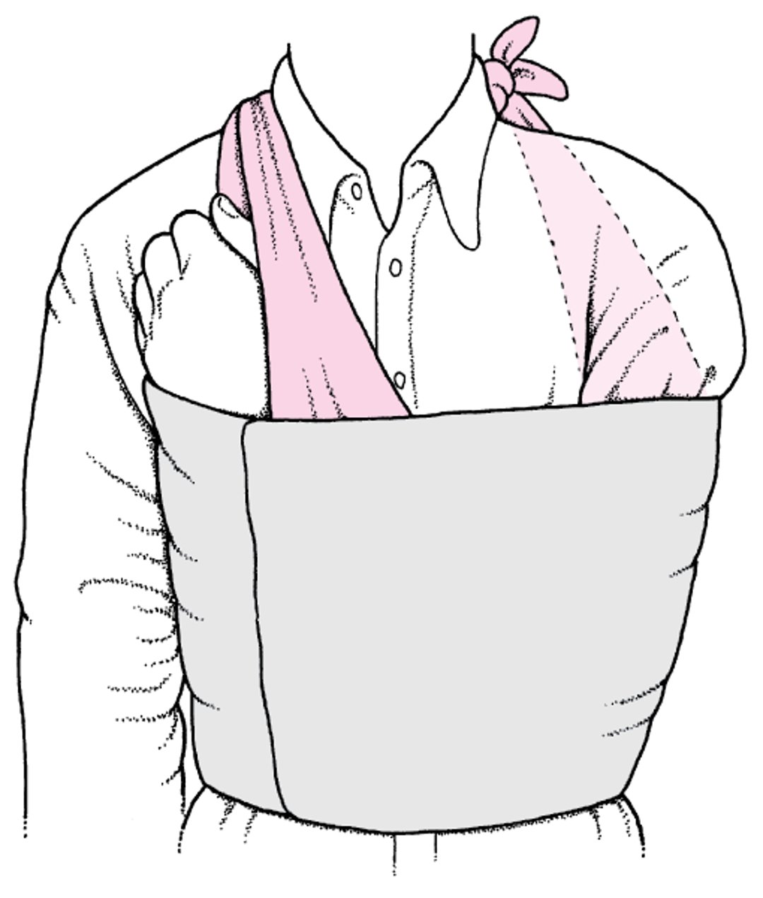 Schlinge und Bandage