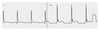 Abnormal ECG Showing J (Osborn) Waves (V4)