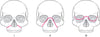 Clasificación de Le Fort para fracturas del macizo medio facial