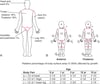 (A) Rule of Nines (for Adults) and (B) Lund-Browder Chart (for Children) for Estimating Extent of Burns