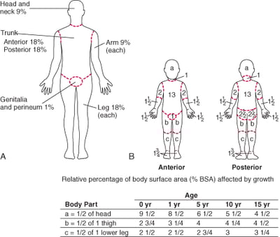 (A) Rule of Nines (for Adults) and (B) Lund-Browder Chart (for Children) for Estimating Extent of Burns