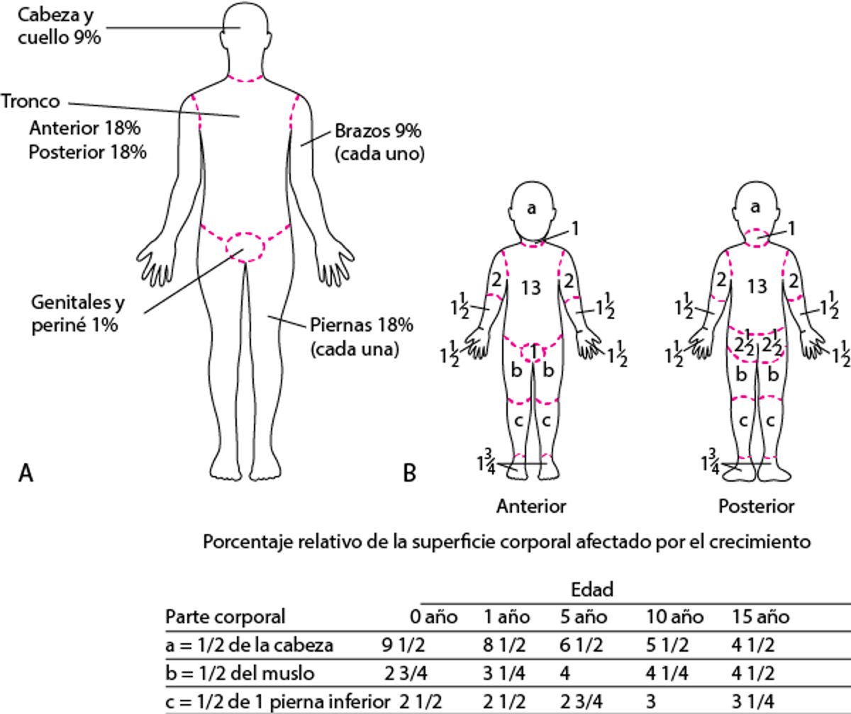 (A) Regla de los nueves (para adultos) y (B) Diagrama de Lund-Browder (para niños) para estimar el alcance de las quemaduras