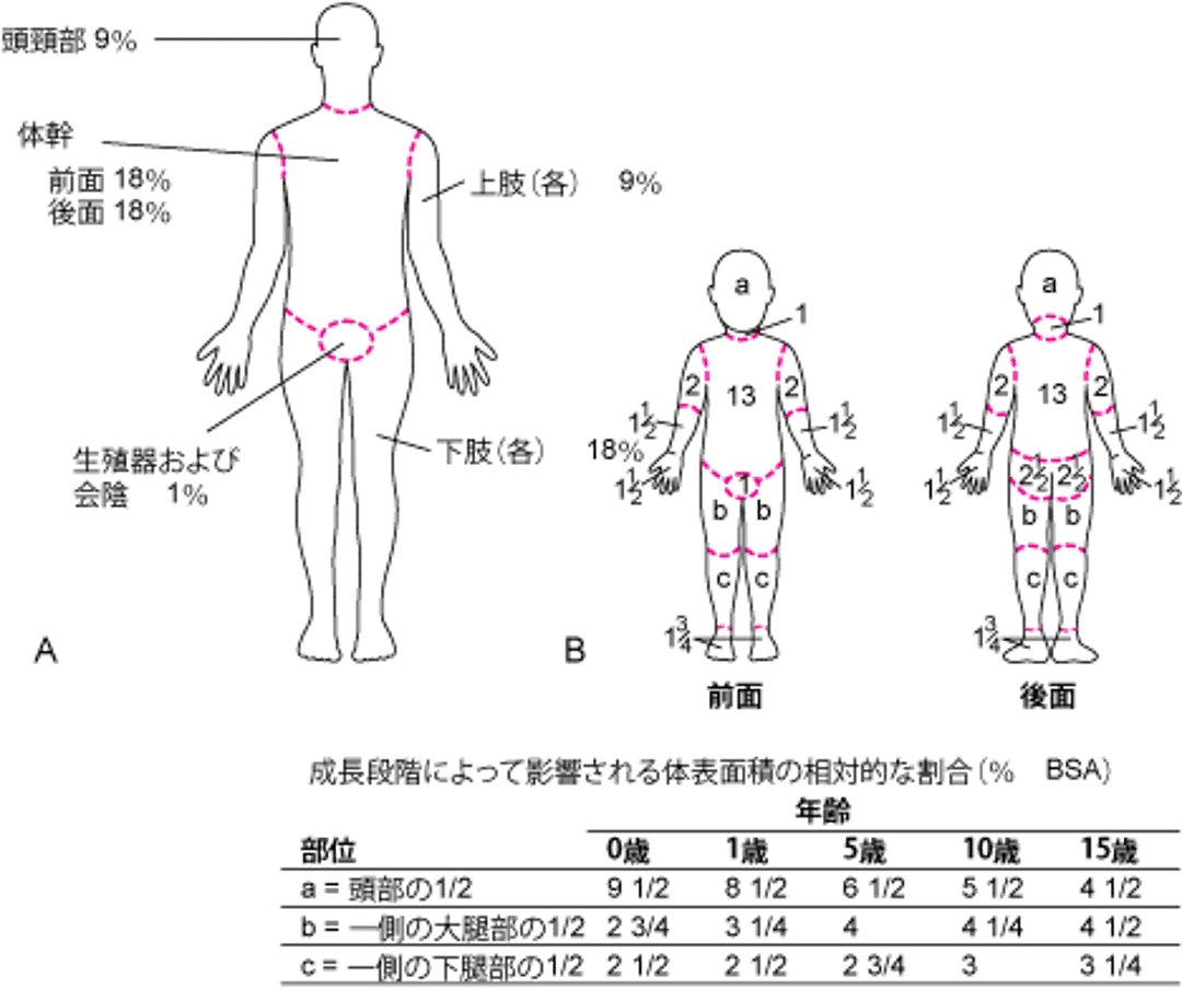熱傷範囲の推定に用いられる（A）9の法則（成人用）および（B）Lund-Browderチャート（小児用）