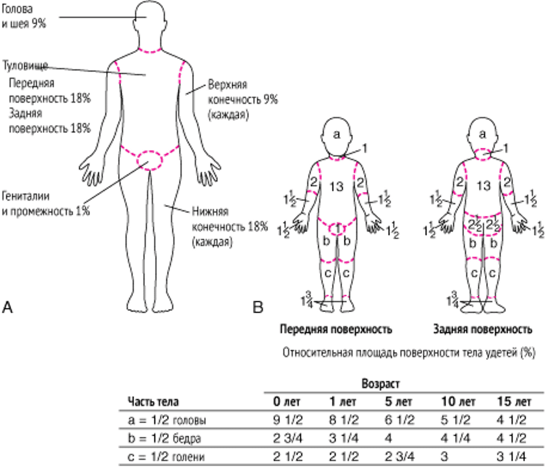 (А) Правило девяток (для взрослых) и (В) таблица Лунд-Браудера (для детей) для определения площади ожогов.