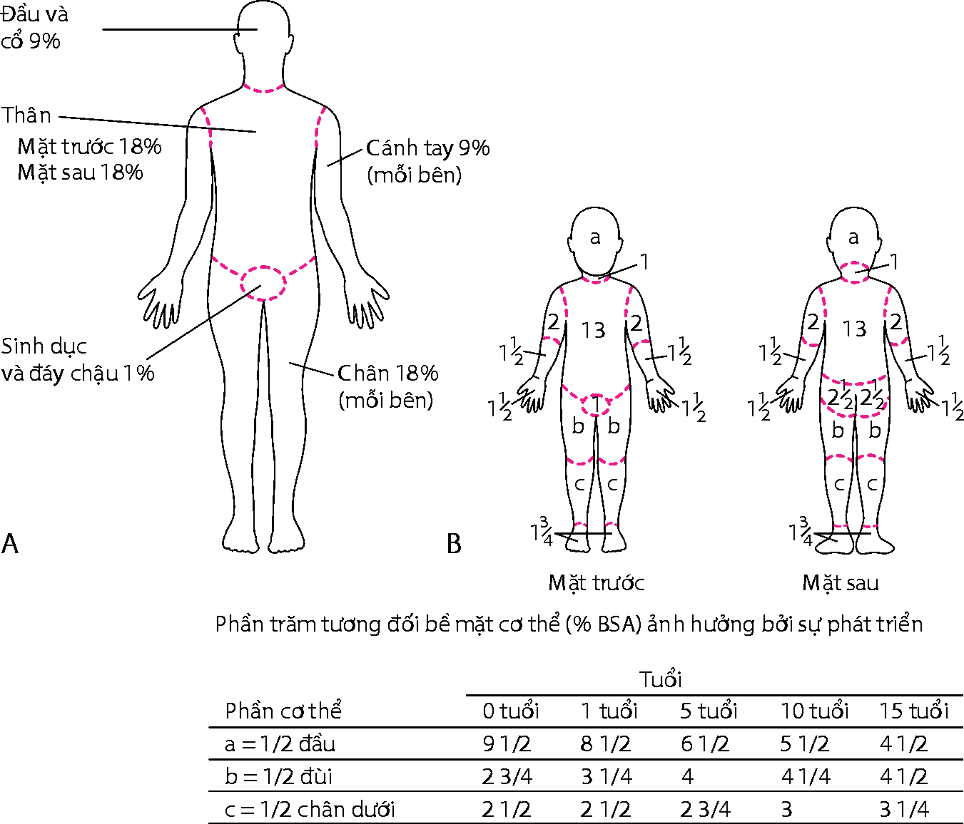 (A) Quy tắc số chín (đối với người lớn) và (B) biểu đồ Lund-Browder (đối với trẻ em) để ước lượng diện tích bỏng