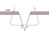Simple Cutaneous Suture
