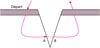 Suture percutanée simple