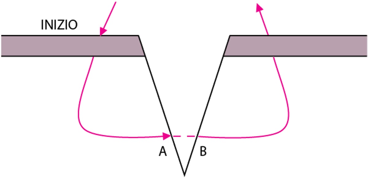 Sutura cutanea semplice