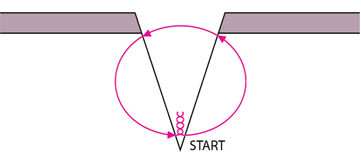 Simple deep dermal suture