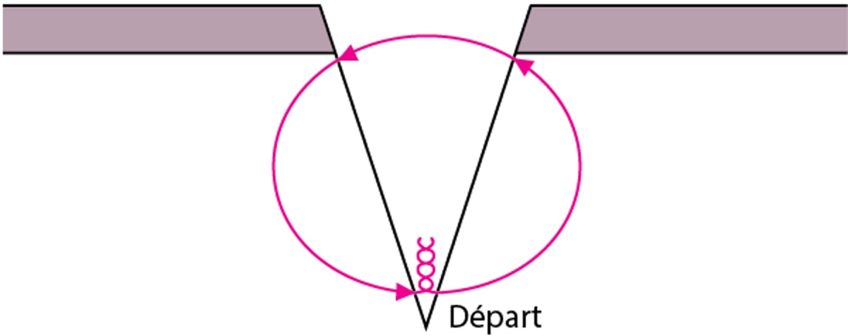 Sutures profondes dermiques simples