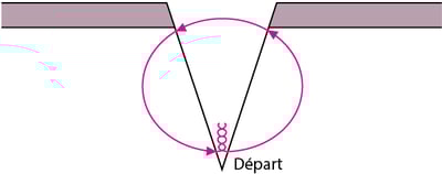 Sutures profondes dermiques simples