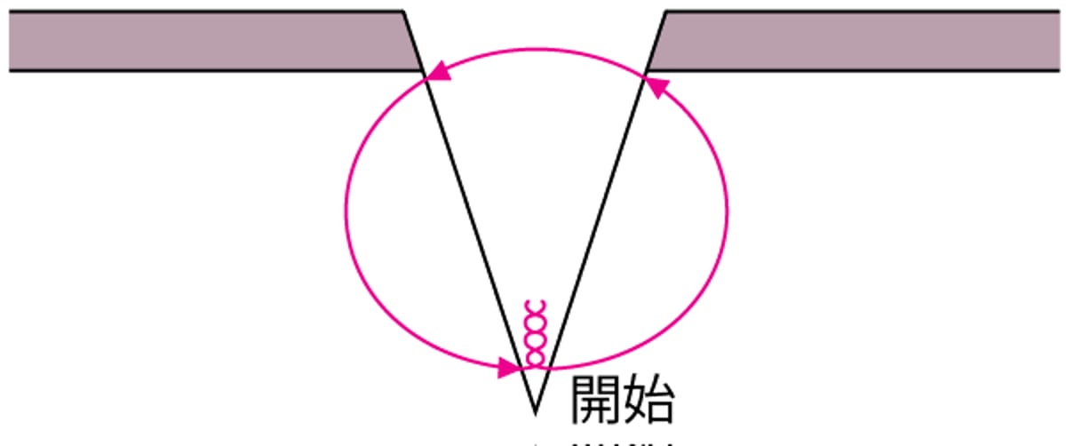 単純な真皮縫合