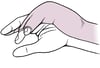 Ulnar Gutter Splint
