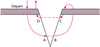 Suture matelassée verticale